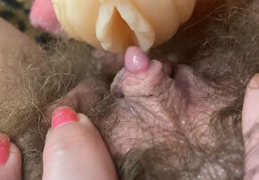 clitoris cono